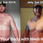 Transform Your Body with Medi-Weightloss