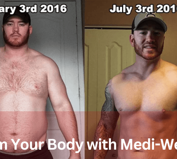 Transform Your Body with Medi-Weightloss