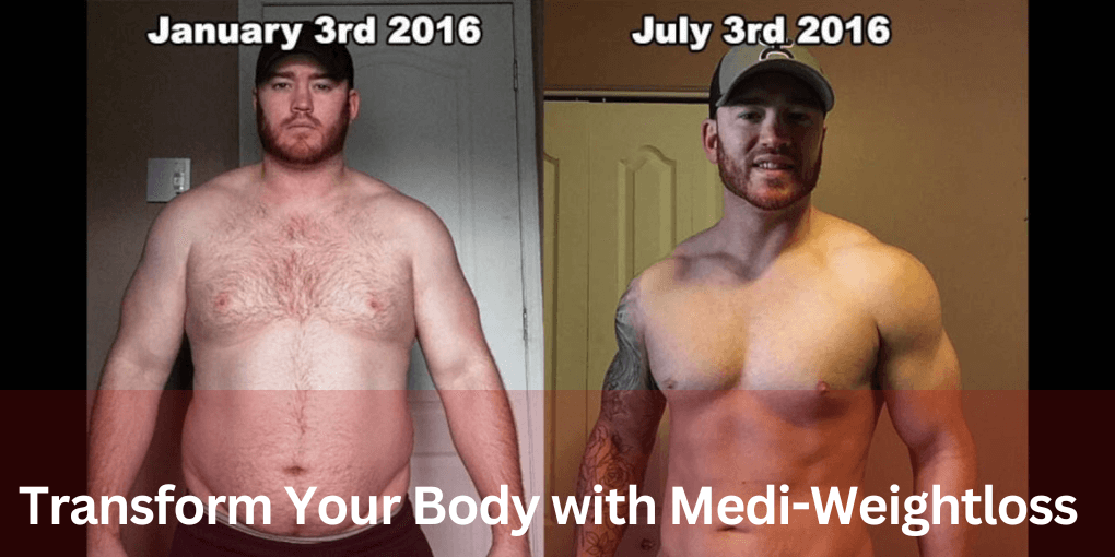 Transform Your Body with Medi-Weightloss 