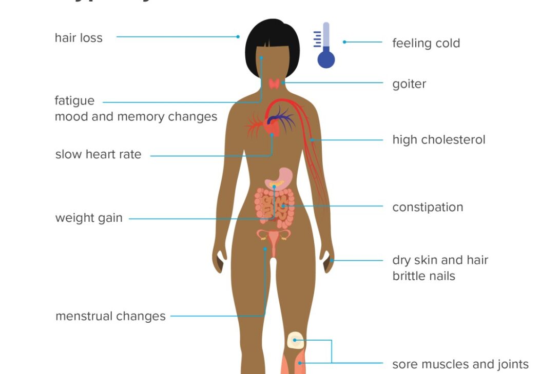 How Do You Know If Weight Gain is Due to Thyroid