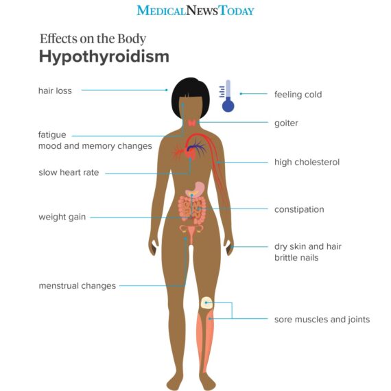 How Do You Know If Weight Gain is Due to Thyroid